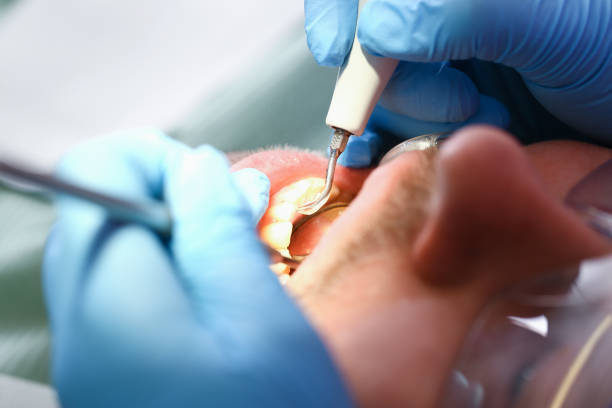 Best Emergency Tooth Extraction  in Oral City, FL